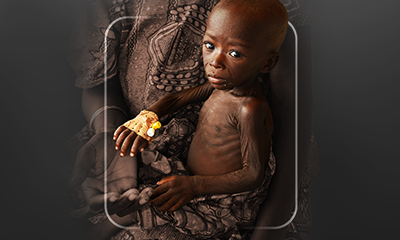 Beslenme Sağlığı