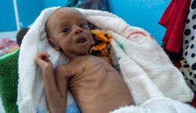 Peki Ya Her Gün Açlıktan Hayatını Kaybeden 8220 Çocuk?