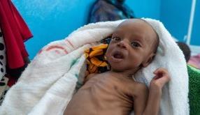 Bir Öğün Değil, Bir Ömür