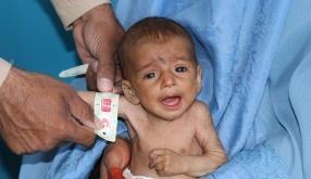 2021 Yılında Afganistan’da Binlerce İnsana Ulaştık