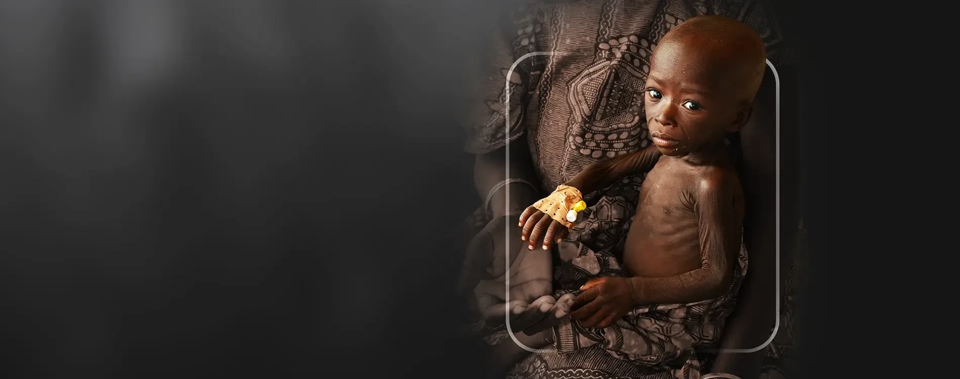 THERE IS ONLY ONE WAY: NUTRITION TREATMENT!